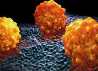 Die 5 aggressivsten Krebsarten: Reduzieren Sie Ihr Risiko um fast die Hälfte news-16092024-045034