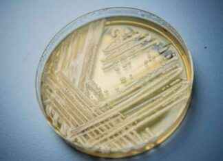 Experten warnen vor gefährlichen Pilz-Infektionen news-21092024-222529