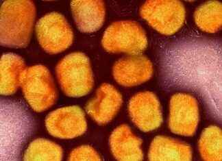 Erster Fall der neuen Mpox-Variante in Deutschland: Krankheitsausbruch und Maßnahmen news-22102024-161729