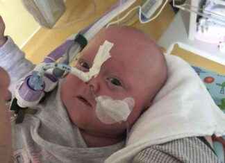 Gesundheit: Europas frühstes Frühchen kämpft um sein Leben – Geburtsgewicht 450 Gramm news-10112024-012953